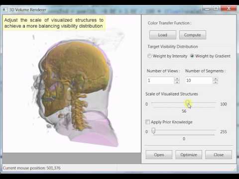 Automatic Transfer Function Design for Medical Visualization - YouTube