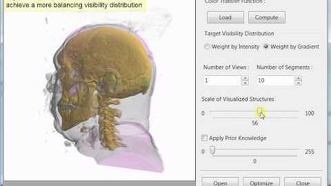Automatic Transfer Function Design for Medical Visualization