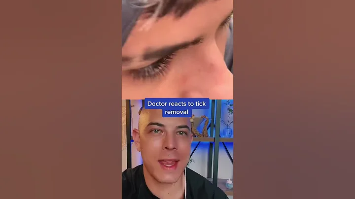 Crazy Tick Removal | Doctor Reacts