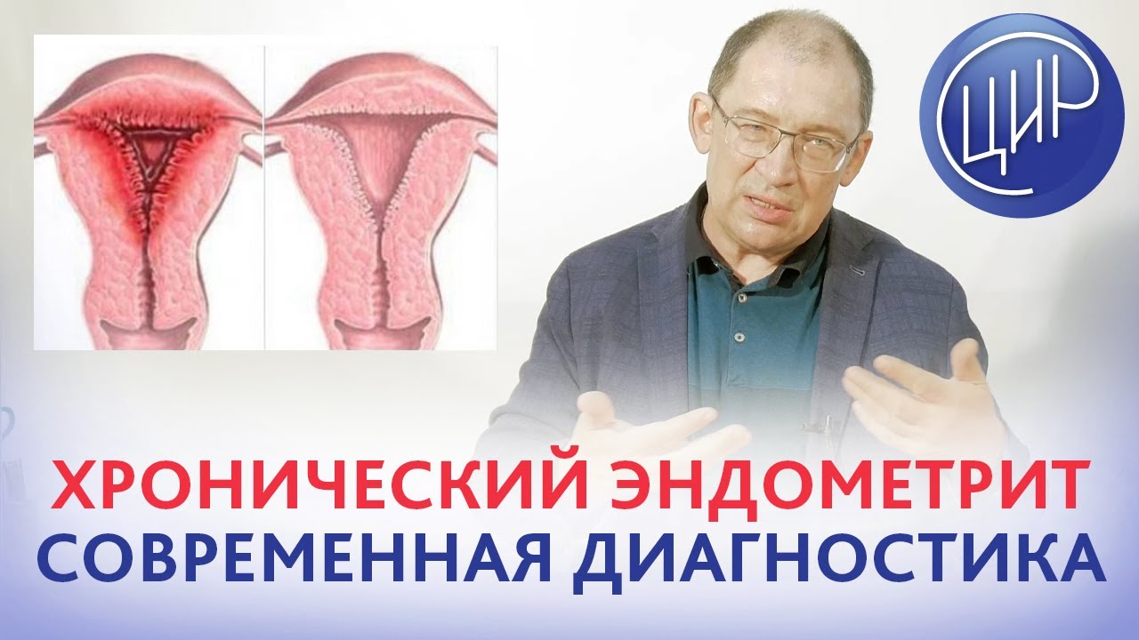 Хронический эндометрит. Гипердиагностика и современные принципы ...