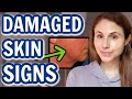 How to tell when your SKIN BARRIER IS DAMAGED| Dr Dray