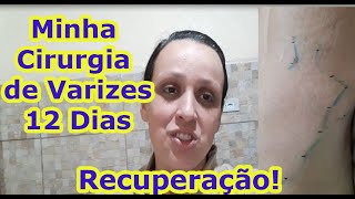 Cirurgia varizes anke de após contusões