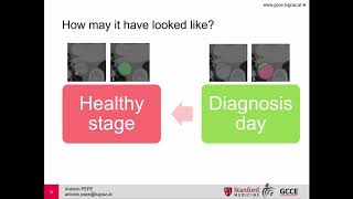 Semi-supervised Virtual Regression of Aortic Dissections Using 3D Generative Inpainting (Talk)