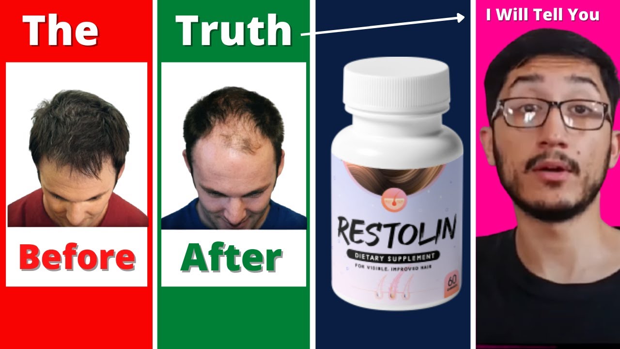 Restolin Hair Before And After | Restolin Hair Growth Reviews | Restolin Hair Growth | Restolin Hair