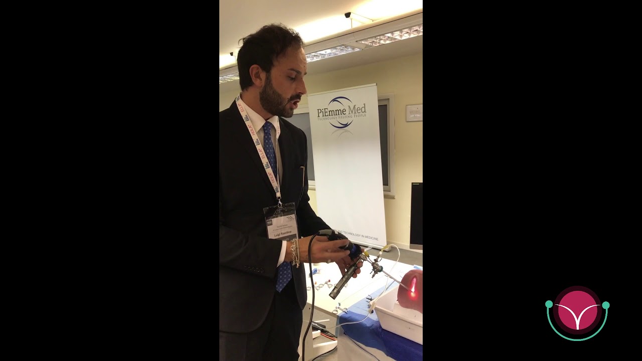 #007 - Come si esegue una ISTEROSCOPIA