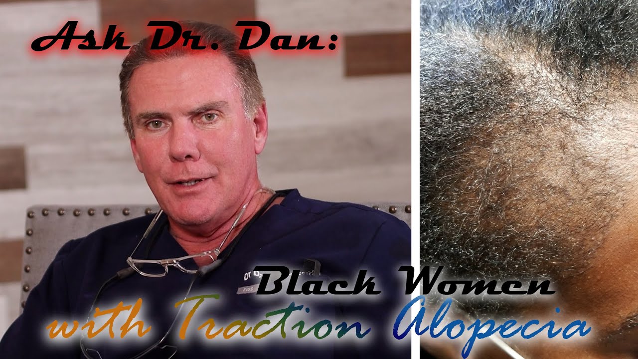 Traction Alopecia for Black Women - Ask Dr. Dan about Hair Transplant Results