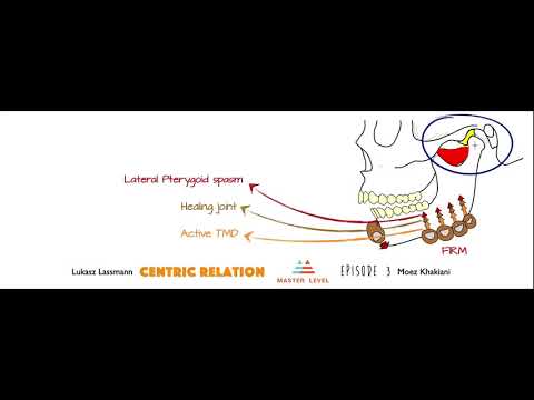 CENTRIC RELATION- Episode 3; Verifying and Recording CR