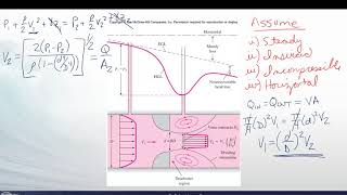 FM10 B1 Obstruction Flow Devices