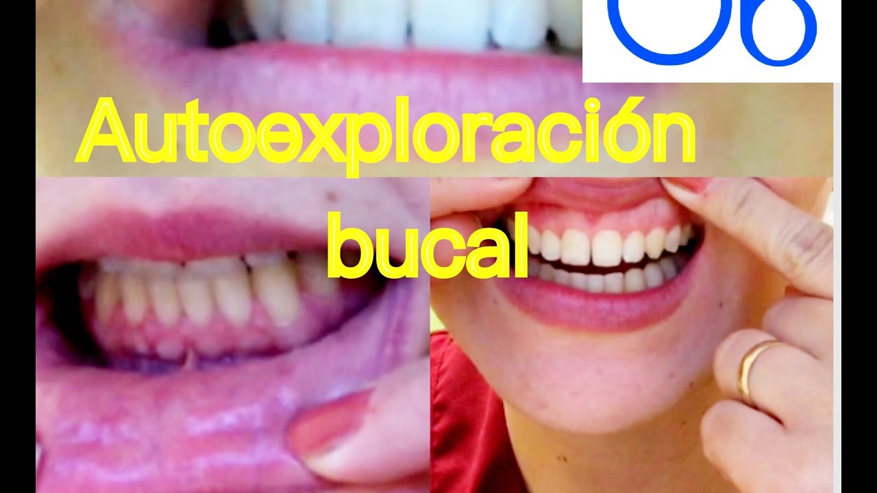 ¿Cómo se hace la Autoexploración bucal?