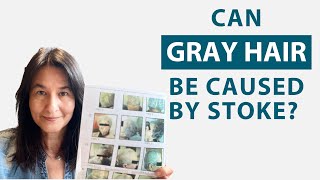 Can Gray Hair be Caused by a Hemorrhagic Stroke? - Proof of Gray Hair Reversal with Cerebrolysin