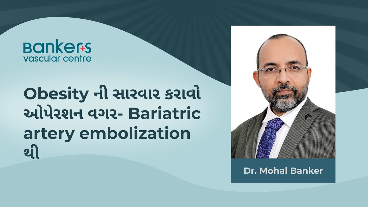 Obesity ની સારવાર કરાવો ઓપેરશન વગર- Bariatric artery embolization થી