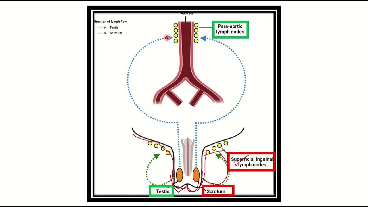 Scrotum And Testis Lymphatic Drainage Mrcs Question Solve Crack Mrcs