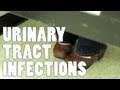 Urinary Tract Infections - 5