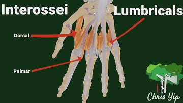 Interossei and Lumbricals of the hand (animated)