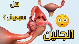 الحمل خارج الرحم كما لم تشاهدة من قبل | مشاهد تعرض لأول مرة