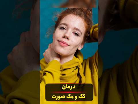 درمان طبیعی کک و مک صورت با آب جعفری و آبلیمو کک و مک