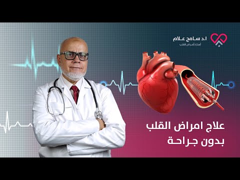 علاج امراض القلب بدون جراحة