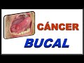 CÁNCER BUCAL CÉLULAS ESCAMOSAS 𝐎 CARCINOMA BUCAL