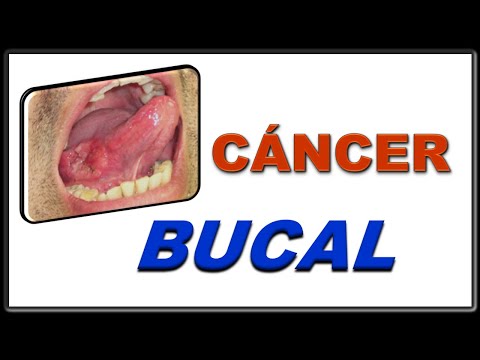 Vídeo: Càncer De Boca (condrosarcoma) En Gossos
