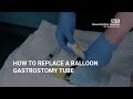 How to replace a balloon Gastrostomy Tube