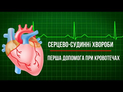 Серцево-судинні захворювання та їх профілактика. Перша допомога при кровотечах