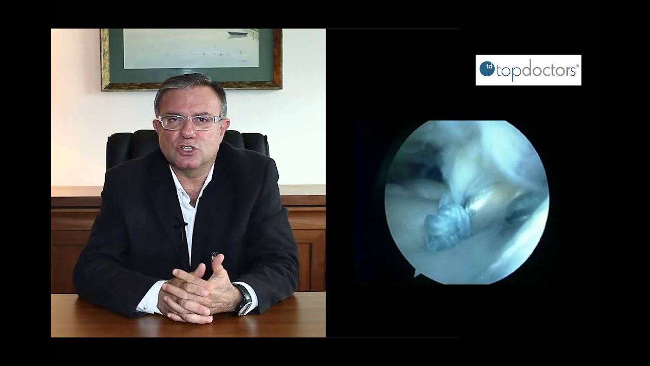 Cirugía de hombro en lesiones deportivas top movies on netflix