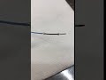 Angioplastie Angioplasty Angioplastie Angioplasty