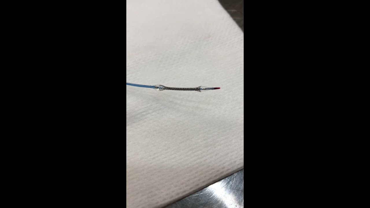 Angioplastie Angioplasty