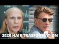 Prótesis capilar INCREIBLE ANTES Y DESPUES - PROTESI CAPELLI PRIMA E DOPO - HAIR SYSTEM BEFORE AFTER