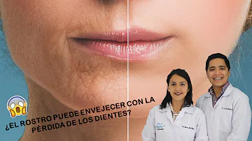 ¿La pérdida de dientes te cambia la cara?