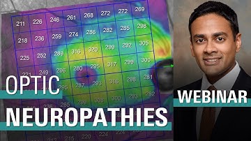Diagnosing and Treating Glaucoma