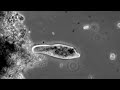 The darkfield side of ciliate excretion