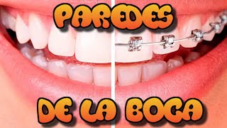 Las paredes de la boca.