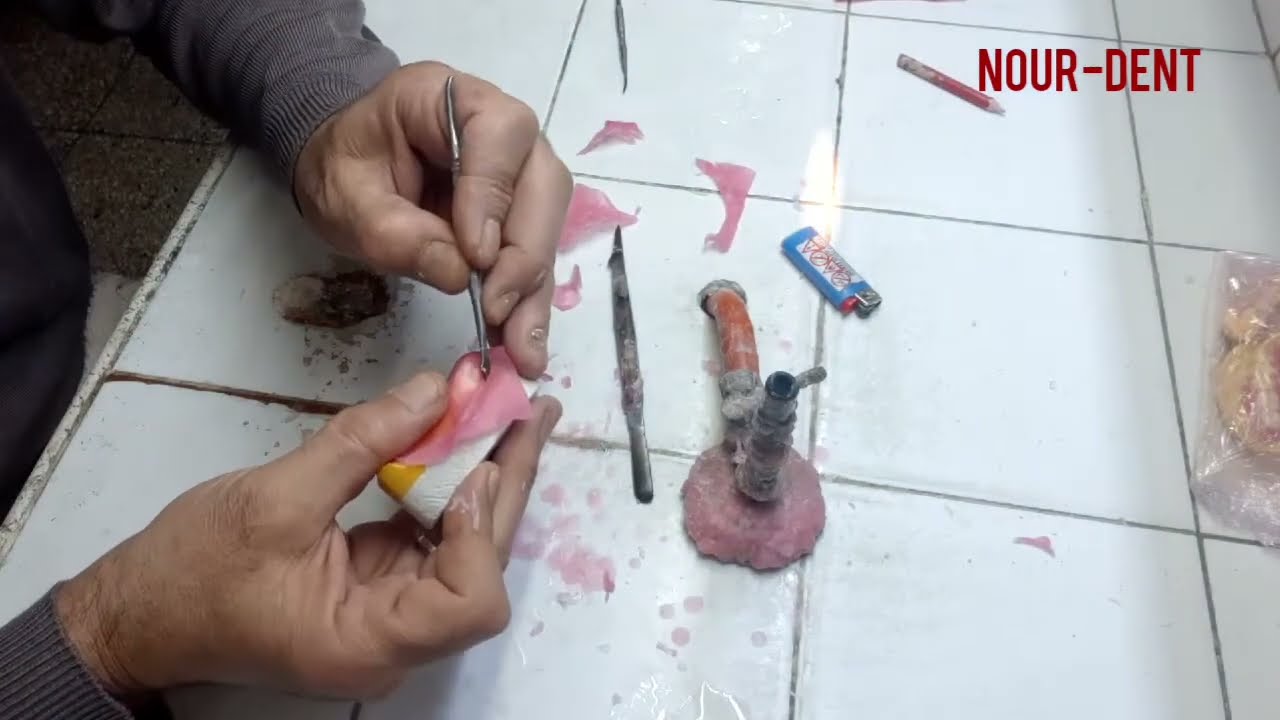 La #maquette d'occlusion en #cire