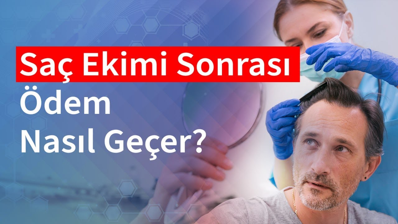 Saç Ekimi Sonrası Ödem | Medical Park