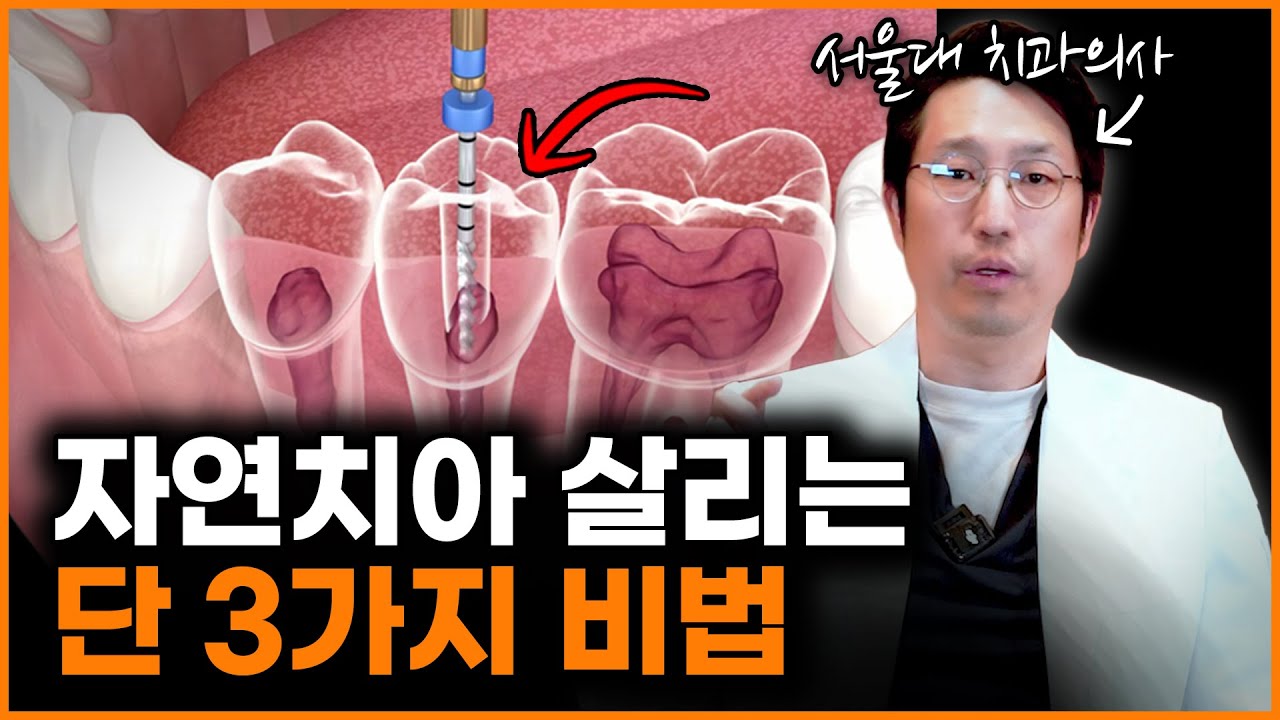 아무도 안말해주는 내 치아 무조건 살리는 모든 방법 총정리!