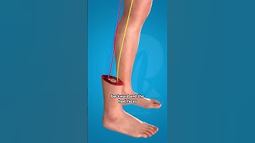 Rotationplasty Procedure (3D Animation) #drone #theflash #space #automobile #scifi #epic #anatomy