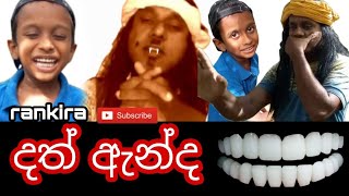 දත් ඇන්ද/dath anda/rankira රංකිරා