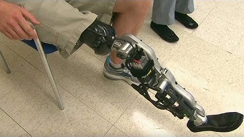 Bionic leg can 