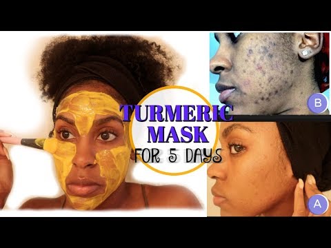 I Used a TURMERIC MASK for  Week and THIS HAPPENED! | How to Fade Dark Spots