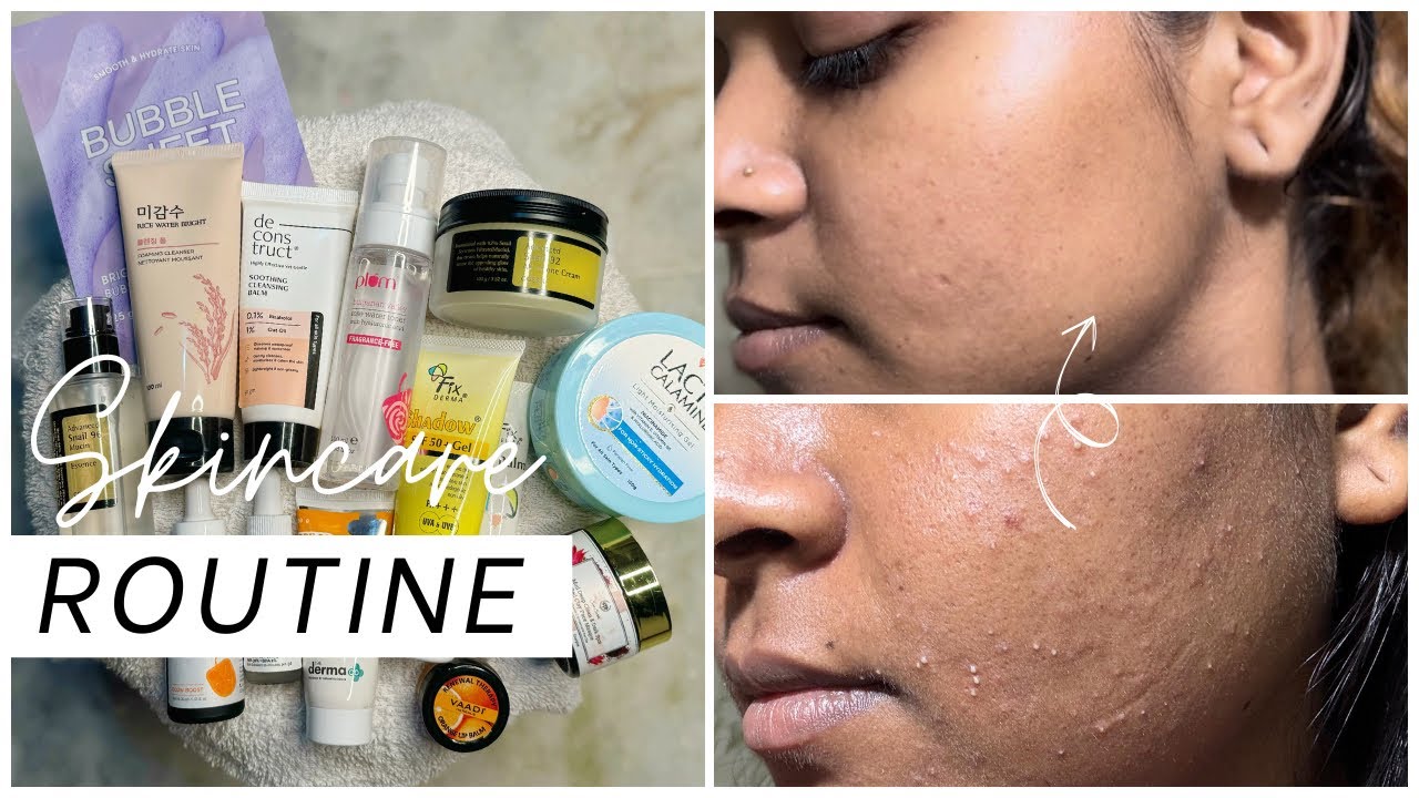 How i take care of my Acne Prone Skin💦🧴 #nighttimeskincare - YouTube