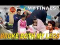 Struggle before  after my legs broke  3 months bed rest  avinash ashok  appulovesappu djd