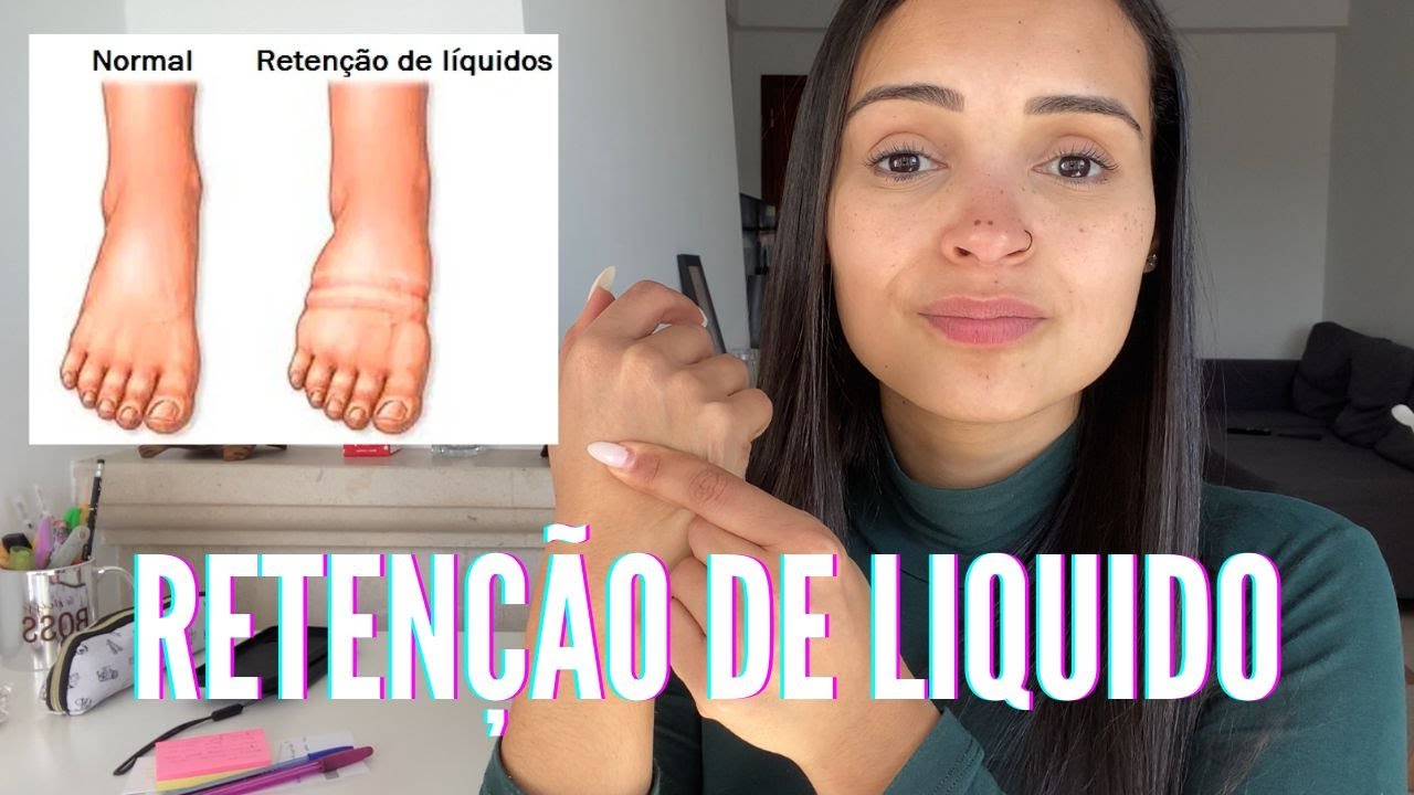 COMO ELIMINAR A RETENÇÃO DE LIQUIDO | COMO DIMINUIR A RETENÇÃO DE ...