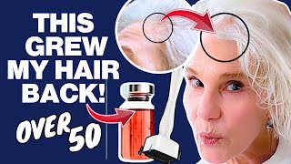 Stop Hair Fall Now! (My Best Tip for Hair Growth and Thicker Hair Over 50) by Beyond50Skin 1,357 views 5 months ago 22 minutes