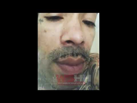 Gunplay Shows The Real Consequences Of Cocaine Use On Live 