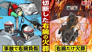 【実話】切断した右腕の火葬。事故で損傷。右腕だけ火葬する。