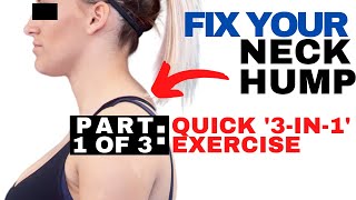 QUICK Fix for Neck Hump | Dowager