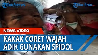 Cemburu dengan Adik, Seorang Kakak Coret Wajah Bayi Gunakan Spidol