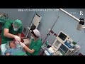 Surgery day : Girl going under General Anesthesia |  Intubation &  Sleep | Narkos | Διασωλήνωση