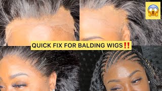 NEW HAIR HACK‼️🤯😱 HOW TO QUICK FIX YOUR BALDING WIG 🔥| MAJOR HAIR TRANSFORMATION 🤯🔥| TheBhSlay✨